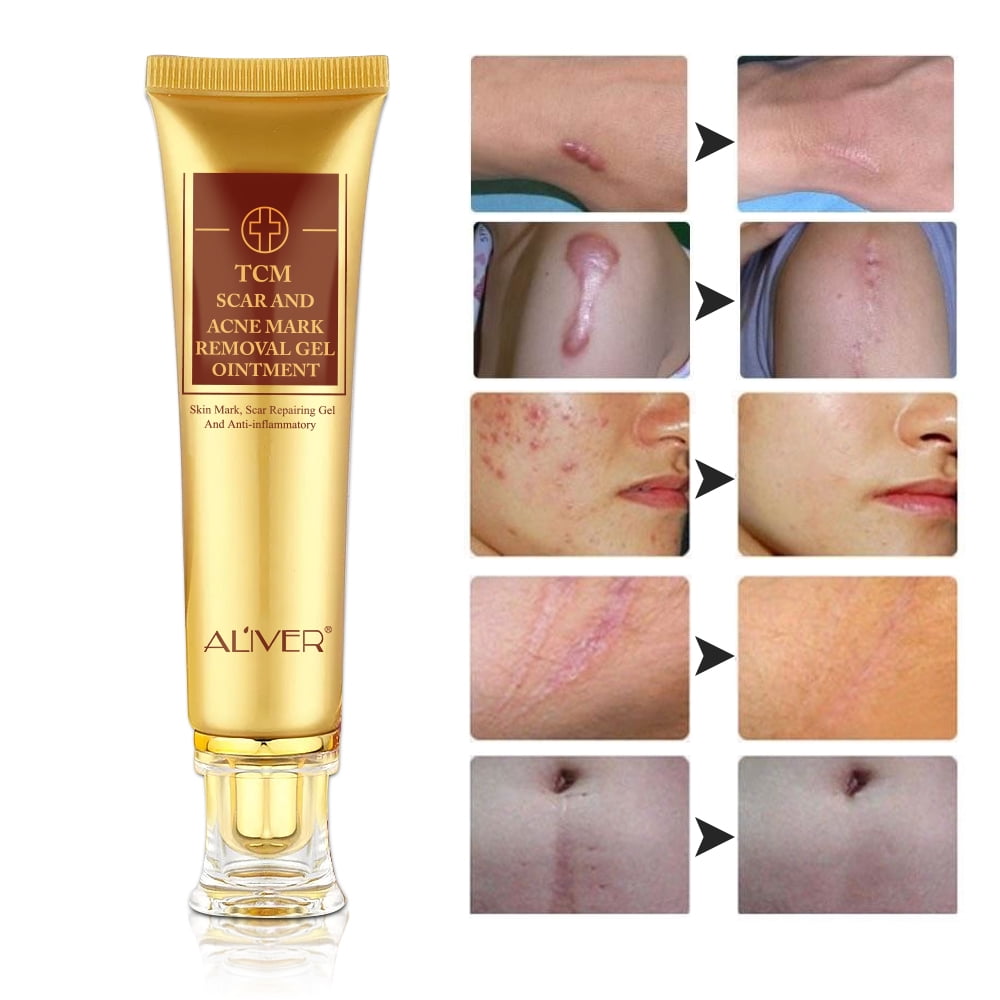 ALIVER Scar Cream - TCM Scar and Acne Mark Removal Gel Ointment for Scars, Burns, Stretch Marks, Acne Spots, Skin Redness Curing - 3 Pack
