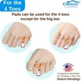 thumbnail image 4 of Chiroplax Tailor's Bunion Corrector Pads Bunionette Pain Relief Pinky Toe Straightener Separator Cushion Splint Protector Shield Spacer (4 Pads, Shims - Size Regular), 4 of 6