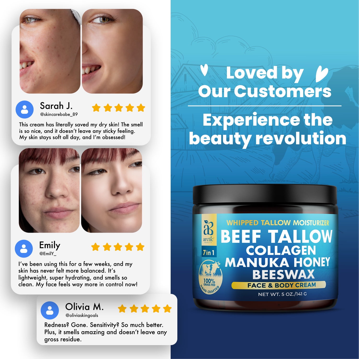 Arctic Beauty Organic Grass-Fed Beef Tallow Balm with Manuka Honey, Aloe Vera & Collagen, Natural Moisturizer, 5 oz