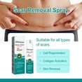 thumbnail image 5 of KUIZAP Scar Care Spray Fade Scar Pregnancy Surgery Scar Smoothing Skin Care spray, 5 of 5