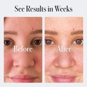 Geologie Clear System Acne Treatment System Skin Repair Moisturizer Night Use Cream, 2 Fl Oz (Pack of 1)