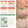 thumbnail image 2 of Parche invisible para acné, limpieza de maquillaje, parche para acné, cierra el acné y desvanece las marcas de acné, limpieza hidratante y reparadora, 2 of 5