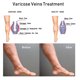 thumbnail image 2 of Crema reparadora de venas, masajea las piernas para aliviar el dolor, draga los meridianos, dilata las venas, cuida y repara la crema Kaili Sencillez, 2 of 5