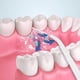thumbnail image 5 of Flosser de agua inalámbrico recargable profesional limpiador dental portátil impermeable irrigador bucal dental con tanque de agua limpiable para el hogar y viajes, cuidado de aparatos ortopédicos y puentes (rosa) JM, 5 of 5