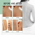 thumbnail image 5 of Clear Out Stock! Awwp Green Acne Spray*1 Bottle Back Spray Body Spray Gentle Oil Control Redness Smooth Skin Cleans Pores Moisturizes Easy to Use and Formula for All Skin Type100Ml, 5 of 8