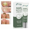 BONINGGG Nail Effective Toenail Gel Foot Nail Growth Cuticle The
