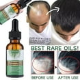 thumbnail image 2 of Rosemary Oil for Hair Growth, 100% Pure Natural Organic Rosemary Essential Oil, Biotin Hair Growth Serum for Hair Loss Regrowth Treatment，Nourishment Scalp, Stimulates Hair Growth (2 PCS), 2 of 9