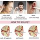 thumbnail image 2 of Innovador juego de herramientas de limpieza de cerumen de resorte: diseño en espiral de acero inoxidable, fácil de usar, kit de eliminación de cerumen oso de fresa  Electrónica, 2 of 5