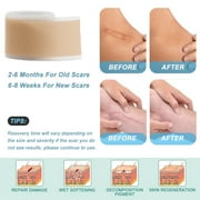 Silicone Scar Sheets (1.6” x 120”Roll-3M), Silicone Scar Tape Roll, Scar Silicone Strips, Scar Removal Sticker for C-Section, Surgery, Burn, Keloid, Acne