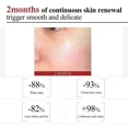 thumbnail image 5 of Suero Facial de ácido salicílico para reparación de poros grandes, antiarrugas, Control de aceite, blanqueamiento, cuidado de la piel, suero de contracción de poros, 5 of 5