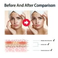 thumbnail image 4 of ZHAOCHENG Exfoliante perfeccionador de la piel con 2 % de BHA, ácido salicílico orgánico, limpiador y exfoliante de poros con extracto de hoja de camelia, 4 of 4