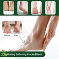 thumbnail image 2 of Fankiway Foot Cream for Dry Cracked Heels and Feet, Tree Oil Foot Cream Is Suitable For Dry, Rough And Cracked Skin. Plant Extracts Pump Foot Moisturizers To Foot Cracking 50ML, 2 of 7