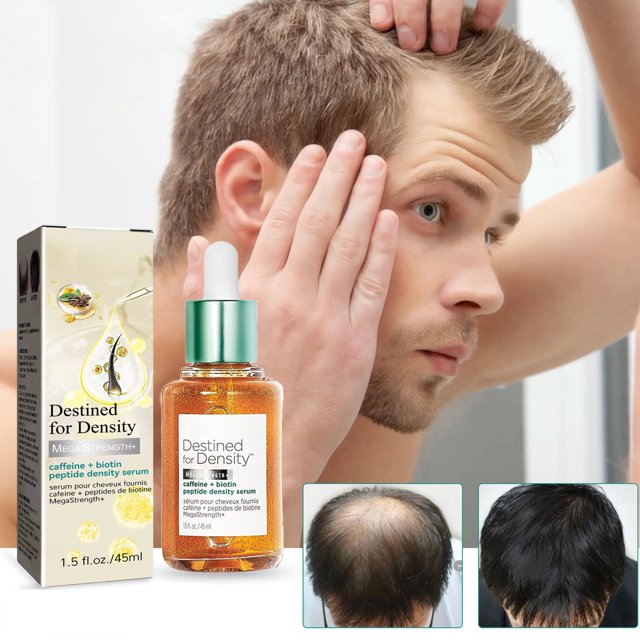 Essence Anti-Chute de Cheveux Forte Nourrissante Racine de Cheveux Épaisse Réparation de la Ligne de Cheveux 45Ml/1.5Oz (1Pcs), Filet de Soin des Cheveux en Polyester Jaune