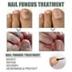 thumbnail image 2 of Extra Strong Nail Fungus Treatment, Best Nail Repair Stop Fungal Growth Effectiv, 2 of 2