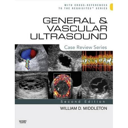 General and Vascular Ultrasound E-Book - eBook