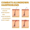 thumbnail image 3 of After Shave Serum Solution Essence for Ingrown Hair Skin Care Treatment, 3 of 6