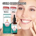 thumbnail image 2 of Gotas para el recrecimiento de las encías, enjuague bucal líquido natural para restaurar las encías, gel terapéutico para las encías, tratamiento para reparar las encías retraídas, 2 of 5