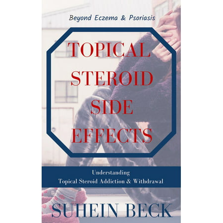 Topical Steroid Side Effects: Beyond Eczema and Psoriasis - Understanding Topical Steroid Addiction and Withdrawal - (Best Topical For Eczema)