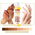 thumbnail image 1 of Pisexur Belleza Maquillaje Aceite exfoliante extrafuerte para nudillos, blanqueador de piel muerta, exfoliante, manchas oscuras, 100 ml/30 mlpara mujeres y hombres, 1 of 9
