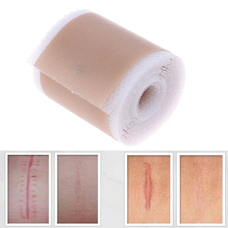 4x150cm Efficient Surgery Scar Removal Silicone Gel Sheet Patch Bandage Tape KC 
