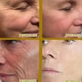 thumbnail image 4 of Suero blanqueador facial con vitamina C, elimina manchas oscuras, pecas, Retinol de melanina, esencia antiarrugas, brillo, cuidado de la piel coreano, 4 of 5