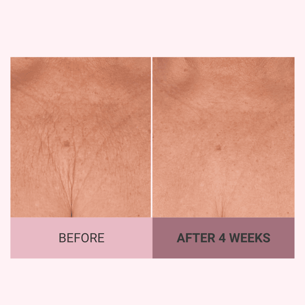 Consult Beaute Champagne Lift Hydrating Firming Body Cream with Pink Pepperslim, Tightens, Tones Crepey Skin, Moisturizer for Dry Skin, Warm Santal, 8 oz.