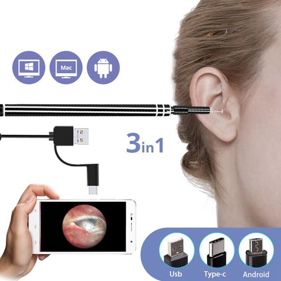 Coofit USB Otoscope Mini Adjustable Multifunctional LED Ear Camera Ear Inspection Scope