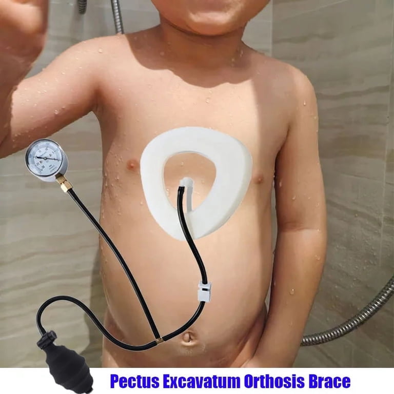 Sternum Correction Device Pectus Excavatum Vacuum Bell - Chest ...