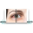 thumbnail image 6 of Dr. Fischer Eyelid Wipes for Blepharitis Dry Eyes,  Eye Cleaner. 6x30 wipes, 6 of 6