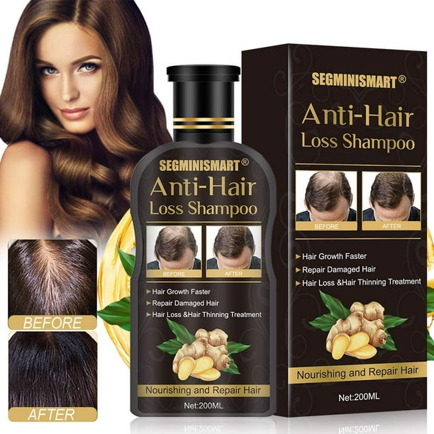 Hair Growth Shampoo,Anti-Hair Loss Shampoo,Hair Loss shampoo,Ginger Hair  Care Shampoo Helps Stop Hair Loss,Promotes Thicker,Fuller and Faster  Growing Hair for Men & Women 