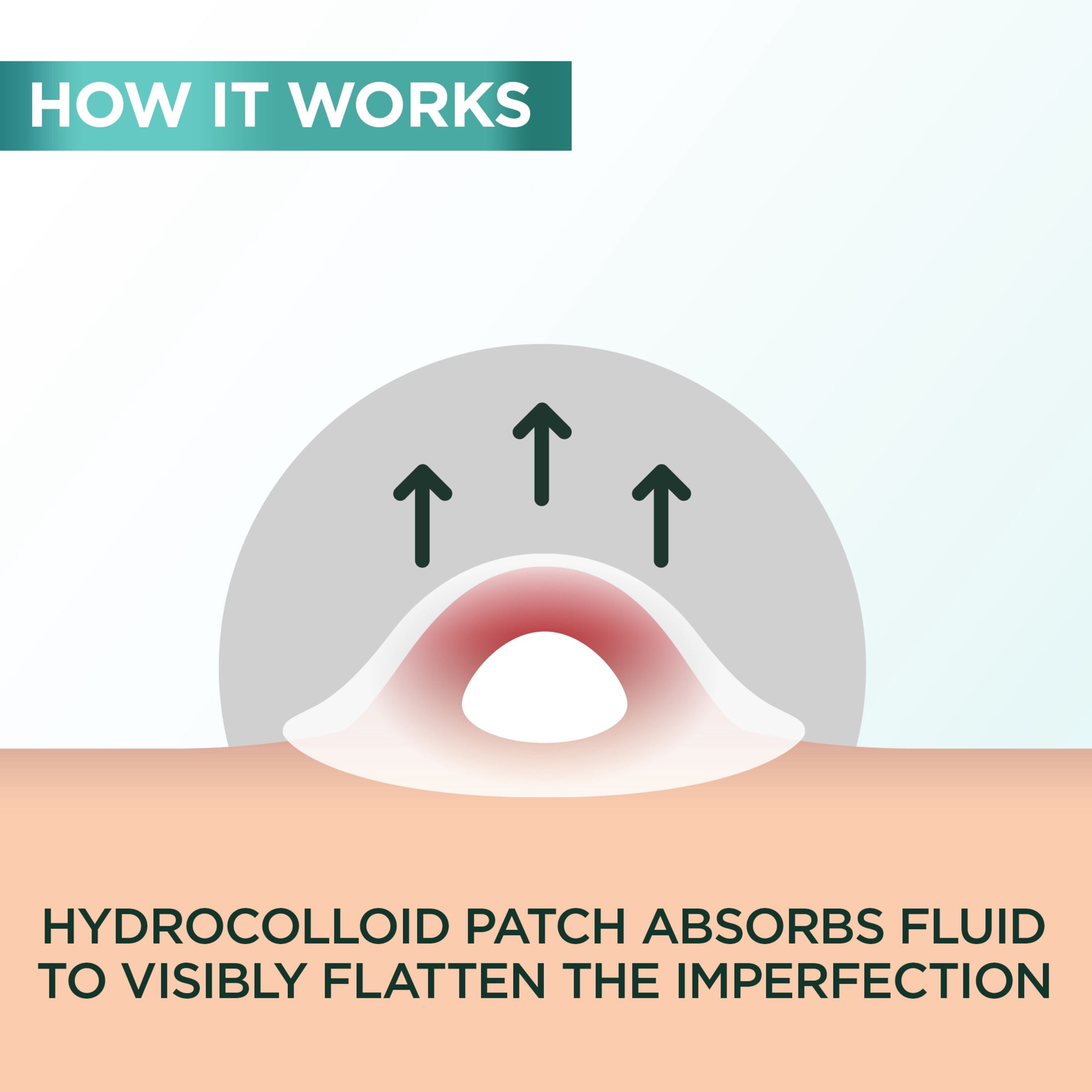 Garnier Imperfection Patch, Invisible Hydrocolloid Patches, 44 Count