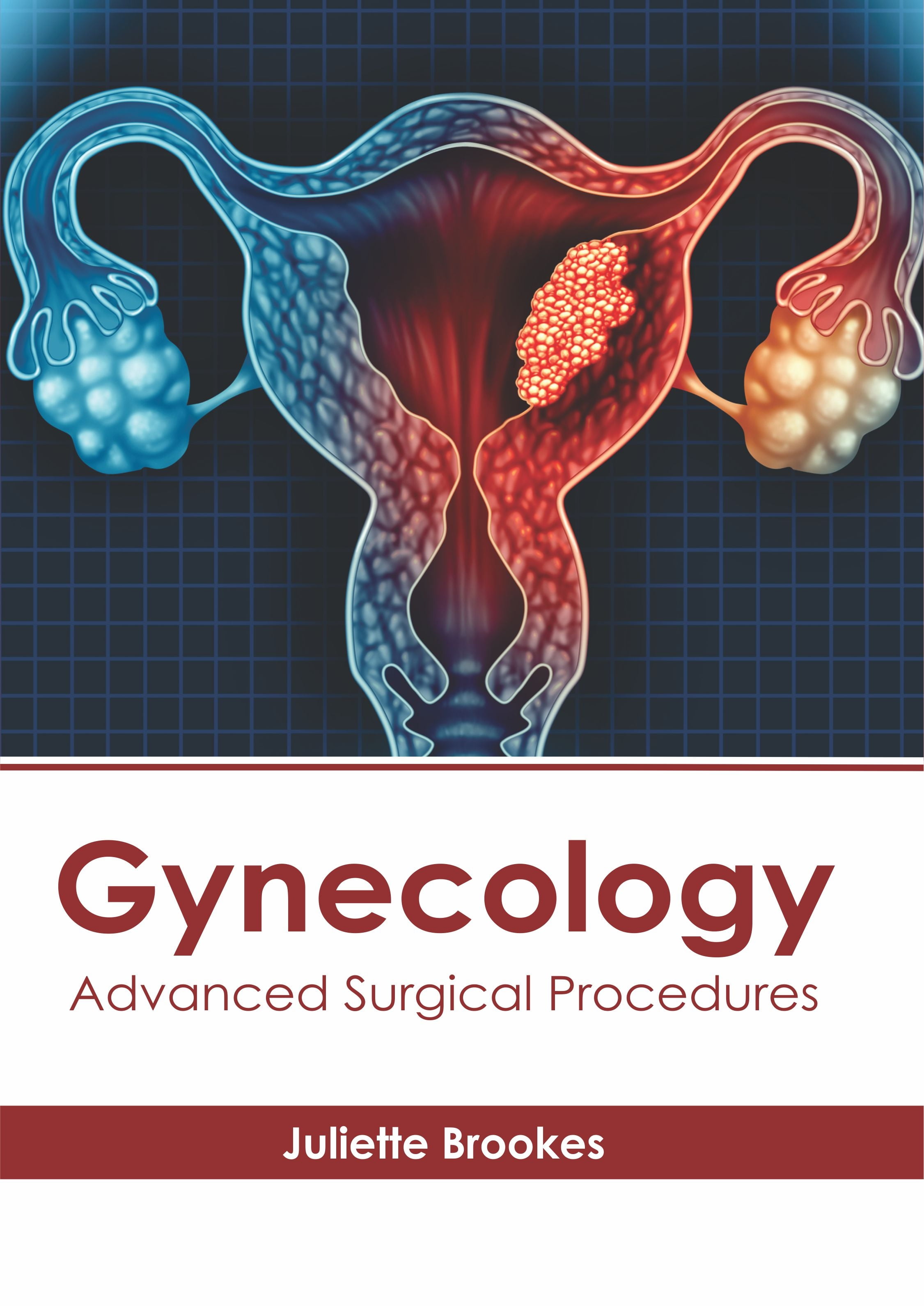 Gynecology Advanced Surgical Procedures (Hardcover)