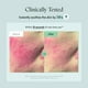 thumbnail image 5 of Crema facial PURITO Centella Cream 50 ml Calmante K-Beauty, 5 of 6