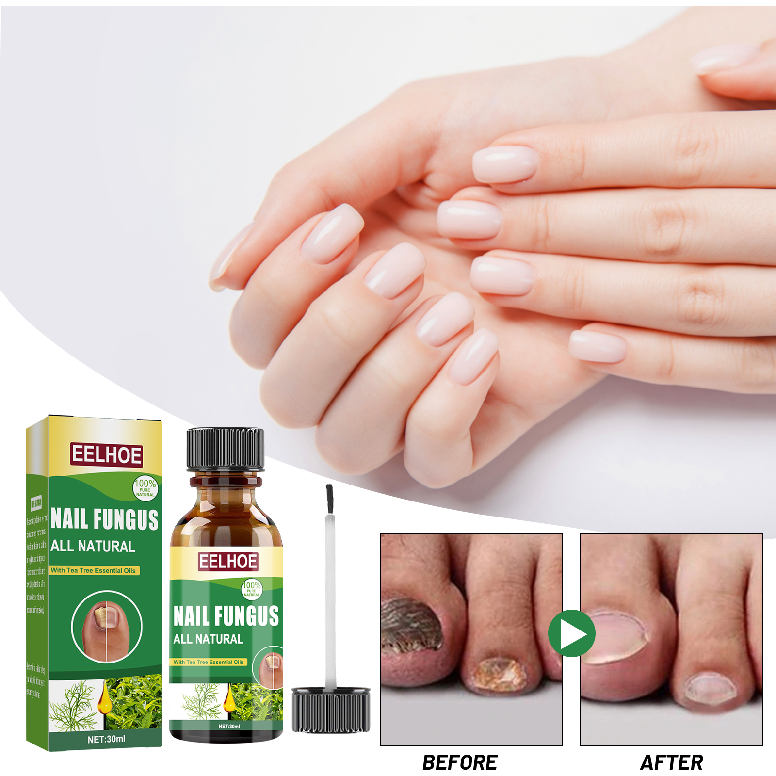 Nail and Toenail Fungus Treatment,Perfect for Both Toenails and