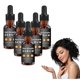 thumbnail image 1 of Suero para el crecimiento del cabello Allurium para mujeres negras, 5 piezas, tratamiento anticaída, cabello más grueso y fuerte., 1 of 5