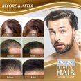 thumbnail image 3 of Biotin Hair Growth Spray Serum Anti Hair Loss Treatment Hair Regrowth for Women Men, 3 of 5