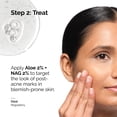 thumbnail image 2 of Sérum The Ordinary Aloe 2% + NAG 2% Solution 30 ml, 2 of 6