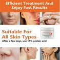 iljndtgbe-replenishing-moisturizing-30g-ever-skin-personal-skin-care