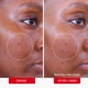 thumbnail image 4 of Almohadillas para el tratamiento del acné First Aid Beauty Maximum Strength 2% SA, 4 of 9