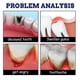 thumbnail image 5 of 2pcs Remedies Spray para dientes y encías, aerosoles instantáneos para aliviar el dolor de muelas, 5 of 5
