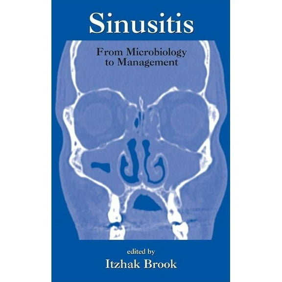 Sinusitis: From Microbiology to Management, (Hardcover)