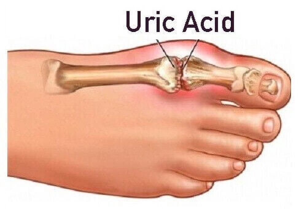 Gout Relief Capsules - Uric Acid Formula 1430mg - Pomegranate 40% Extract