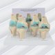 thumbnail image 4 of Knee Kit Osteoarthritis Anatomy Model with Educational Key Card 4 Stage Knee Model Orthopedic Teaching Aids, 4 of 5