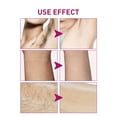 thumbnail image 4 of Gentle Hair Removal Cream – Painless Depilatory Lotion for Women, Arms Underarms & Legs, Plant-Based Formula for Sensitive Skin, 4 of 9