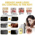 thumbnail image 4 of Sérum de jengibre para el crecimiento del cabello fino, aceite nutritivo botánico natural para el cuero cabelludo 35 ml (3 unidades), 4 of 5