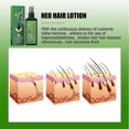 thumbnail image 5 of Spray para el crecimiento del cabello South Moon, 3 unidades | | B, 5 of 5