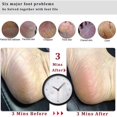thumbnail image 3 of Dww-foot File Callus Remover Foot Scrubber, Professional Pedicure, 3 of 5