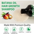 thumbnail image 2 of Aliver Batana Shampoo, Natural for All Hair Types, Reduce Breakage for Women and Men Daily Hair Care 10.56 fl.oz, 2 of 10