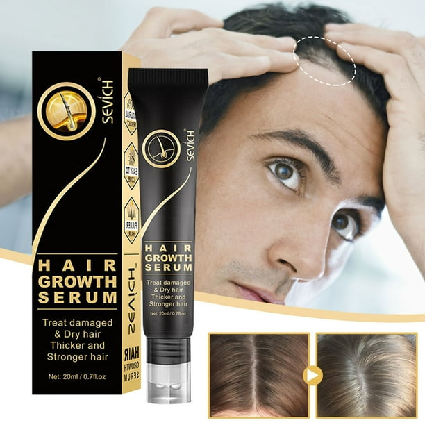 Scalp Massage Liquid, Ball Ball Massage Hair Liquid Scalp Stimulates