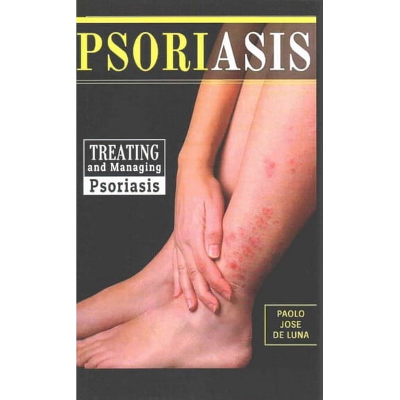 Psoriasis : Treating and Managing Psoriasis